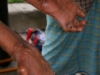 cr-leprosy-clinic-11-640